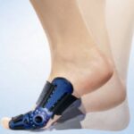 Hallux Valgus Teenbrace